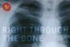 Right-through-the-bone