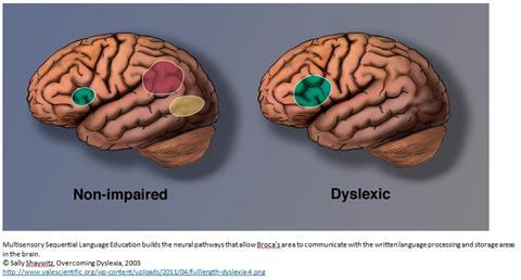 dysmusia